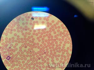 возбудитель пироплазмоза Piroplasma canis (Babesia canis) в анализе крови у собаки